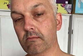 Мужчина получил жуткие травмы, напоровшись на лесной дороге на сучковатое дерево