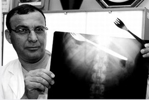 Необычные вещи, найденные внутри людей (20 фото)