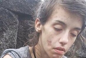 Девушка бросила наркотики, и теперь ее не узнать