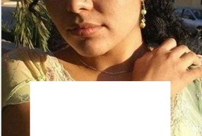 Волосатые руки девушек. Ужас. (5 фото)