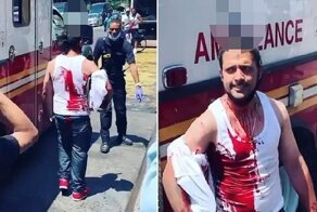 В Нью-Йорке замечен мужчина с ножом в голове