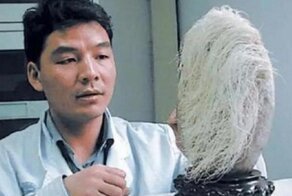 Фермер нашел «волосатый» камень и принес его домой. Оказалось, что «волосы» продолжают расти