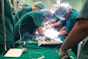 Команда из 100 врачей разделила сиамских близнецов