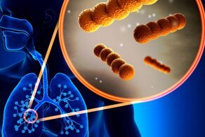 Симптомы бубонной чумы у человека 2020