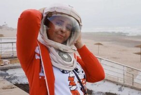 Женщина с аллергией на солнце не выходит на улицу без маски уже двадцать лет