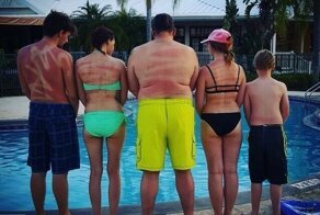 17 фотографий людей, которые перестарались с загаром