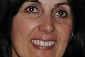 Неудачная подтяжка лица (4 фото)