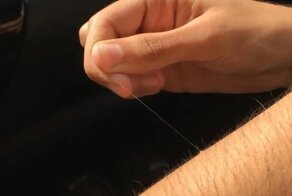 Откуда берутся эти одиночные и абсурдно длинные волосы в разных местах нашего тела?