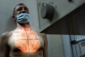 Туберкулез: симптомы и первые признаки в начальной стадии