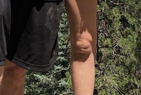 Когда колени напоминают лица плачущих младенцев