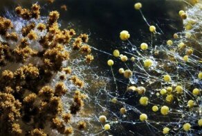 Не кормите грибов в организме