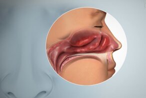 Микс аммиака, яблока и тухлой кожи.  Как коронавирус поменял мое обоняние