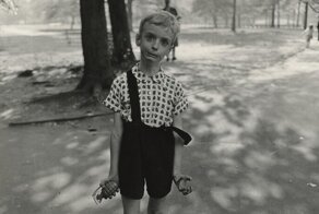 11-летний москвич подорвался на гранате, которую подарил папа