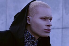 Негр-альбинос присвоил деньги, собранные для движения Black Lives Matter