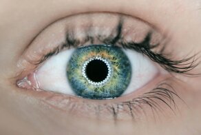 Женщина ослепла на один глаз из-за паразита, живущего в водопроводной воде