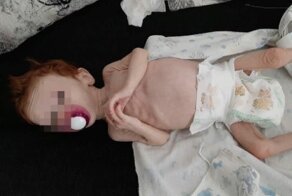 Подруги нашли у жительницы Урала исхудавшую малышку, которую мать прятала в шкафу