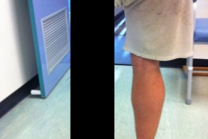 Протез в стиле Терминатора (7 фото)