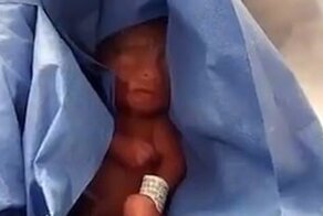 Живого новорожденного посчитали мертвым и на шесть часов убрали в холодильник морга