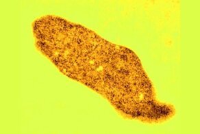 Металлотолерантные экстремофилы: жизнь на планете порой приобретает причудливые формы