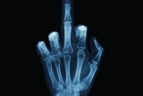 8 ноября 1895 г. 125 лет назад, физик Вильгельм Рентген открыл «рентгеновские лучи»