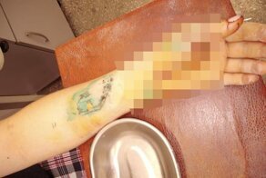 В Горно-Алтайске мужчина не смог смириться с уходом жены и попытался отрубить ей руки