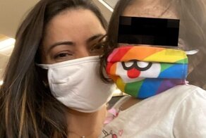 Мама показала, как дела у малышки Луны с врожденной маской на лице