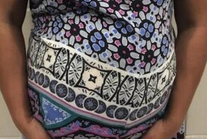 Полицейские Сан-Паулу задержали беременную с необычной начинкой в животе