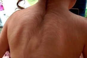 Из-за ошибки испанских врачей 20 детей превратились в «оборотней»