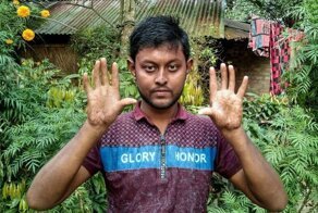 Жизнь без отпечатков пальцев: тяготы семьи из Бангладеша