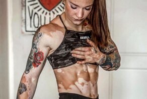 Спортсменка с витилиго поверила в себя благодаря бодибилдингу