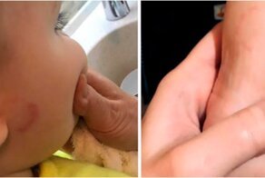 Сотрудники частного детского сада толпой избили мать ребенка