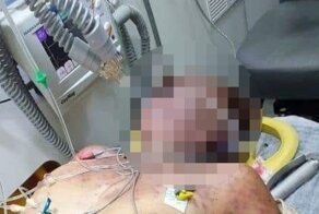 Бразильскую женщину до смерти искусали пчелы