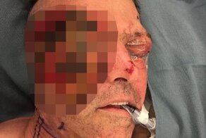 Мужчина сжег половину лица, став участником жуткого ДТП