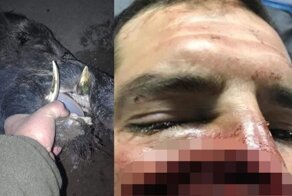 Травма лица от клыка дикого кабана