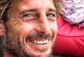 Серфер умер на Бали от странной инфекции, поразившей его шею