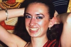 Обладательница самых больших скул показала себя до пластики