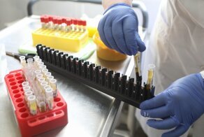 Медики обнаружили первых пациентов с постоянным коронавирусом