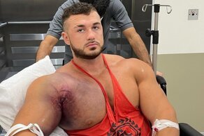 У бодибилдера разорвалась грудная мышца при попытке выжать 220 кг