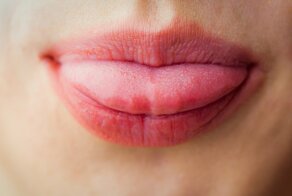 Язык как лакмусовая бумажка: почему краснеет его кончик?