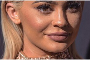 Прыщи, морщины, пластика: как на самом деле выглядит кожа знаменитостей вблизи