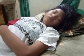 Синдром спящей красавицы: девочка неделями не выходит из сна