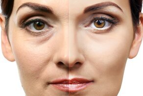 Меняя себя, меняем мир: почему в последнее время стала так популярна пластическая хирургия?