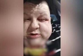 Барнаульский таксист выжил благодаря второму подбородку после того, как неизвестные перерезали ему горло