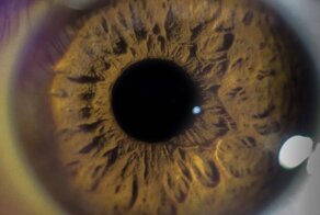 8 безумных и пугающих медицинских случаев