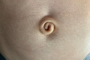Люди с биологическими аномалиями: не мутация, а особенность