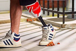 Необыкновенные протезы (13 фото)