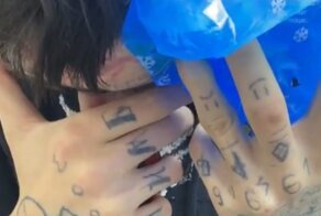 Болезненная процедура удаления татуировок с лица