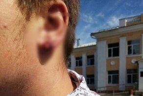 "Не будь п*****м!": директор школы в Курской области порвал ученику ухо, пытаясь снять серьгу