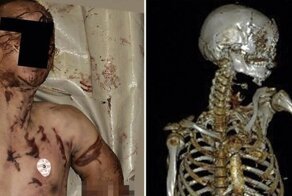 Пилот и пассажир погибли в результате крушения легкомоторного самолета