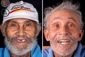 Бразильский стоматолог меняет жизнь бедняков к лучшему